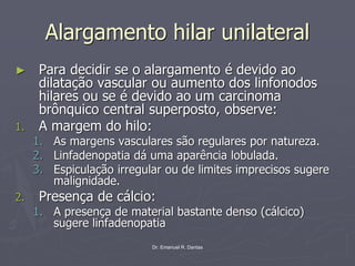Dr. Emanuel R. Dantas
Alargamento hilar unilateral
► Para decidir se o alargamento é devido ao
dilatação vascular ou aumento dos linfonodos
hilares ou se é devido ao um carcinoma
brônquico central superposto, observe:
1. A margem do hilo:
1. As margens vasculares são regulares por natureza.
2. Linfadenopatia dá uma aparência lobulada.
3. Espiculação irregular ou de limites imprecisos sugere
malignidade.
2. Presença de cálcio:
1. A presença de material bastante denso (cálcico)
sugere linfadenopatia
 