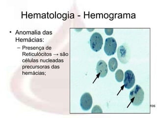Hematologia - Hemograma
• Anomalia das
  Hemácias:
  – Presença de
    Reticulócitos → são
    células nucleadas
    precursoras das
    hemácias;




                          Profa. Eloá Medeiros
                                 01/2008
 