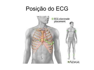 Posição do ECG 