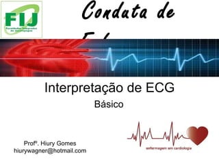 Interpretação de ECG Básico  Conduta de Enfermagem Profº. Hiury Gomes [email_address] 