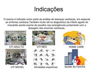 Indicações  O exame é indicado como parte da análise de doenças cardíacas, em especial as arritmias cardíaca.Também muito útil no diagnóstico de infarto agudo do miocárdio sendo exame de escolha nas emergências juntamente com a dosagem das enzimas cardíacas. CTI ADULTO UTI NEO HOME CARE Atividades esportivas UTI MOVEL 