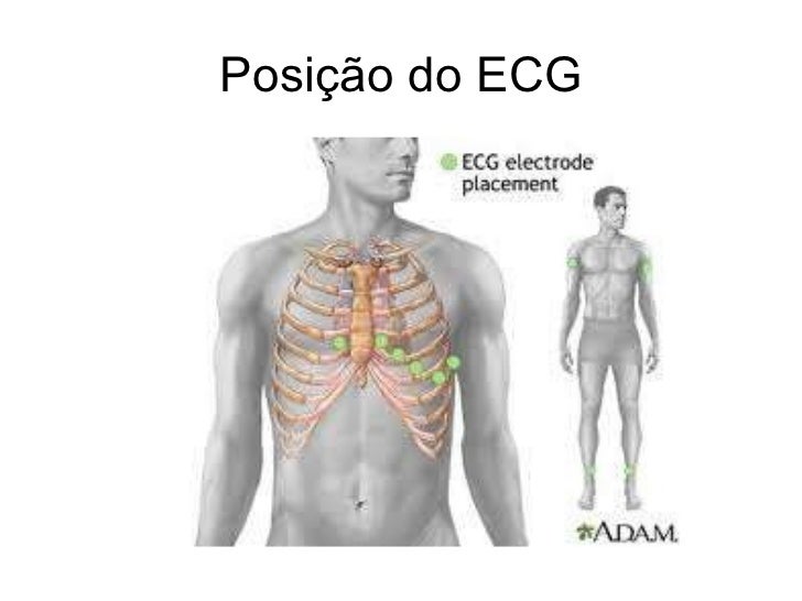 Ecg exame