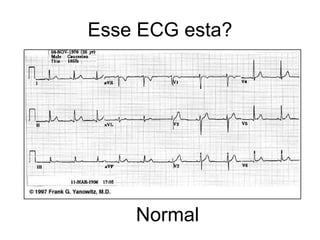 Esse ECG esta? Normal 