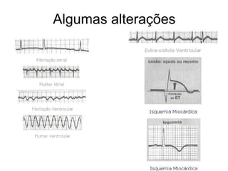 Algumas alterações 