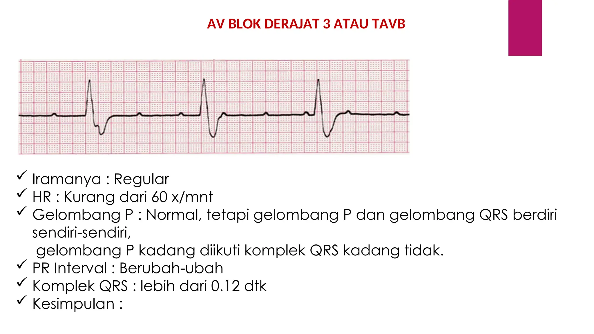 Interpretasi Gambaran EKG Bagi pemula.ppt