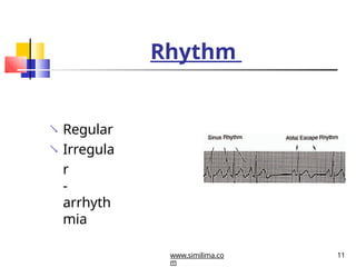 Regular Rythm Engineering interpretation-ecg.pptx by General Physician | PPTX