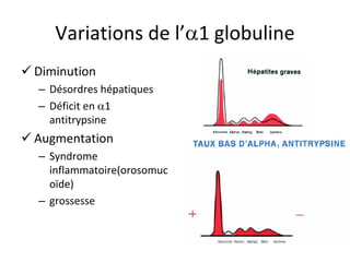Variations de l’1 globuline 
 
Diminution 
– 
Désordres hépatiques 
– 
Déficit en 1 antitrypsine 
 
Augmentation 
– 
Syndrome inflammatoire(orosomuc oïde) 
– 
grossesse  