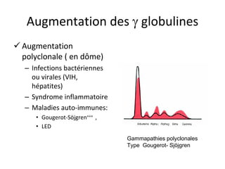 Augmentation des  globulines 
 
Augmentation polyclonale ( en dôme) 
– 
Infections bactériennes ou virales (VIH, hépatites) 
– 
Syndrome inflammatoire 
– 
Maladies auto‐immunes: 
• 
Gougerot‐Söjgren+++ , 
• 
LED 
Gammapathies polyclonales 
Type Gougerot- Sjöjgren  