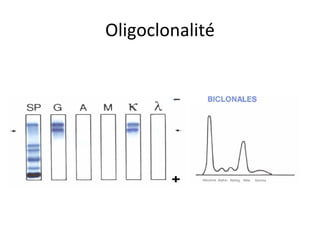 Oligoclonalité  