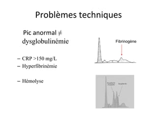 Problèmes techniques 
Pic anormal ≠ dysglobulinémie 
– 
CRP >150 mg/L 
– 
Hyperfibrinémie 
– 
Hémolyse 
Fibrinogène  