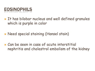 EOSINOPHILS
 It has bilobar nucleus and well defined granules
which is purple in color
 Need special staining (Hansel stain)
 Can be seen in case of acute interstitial
nephritis and cholestrol embolism of the kidney
 