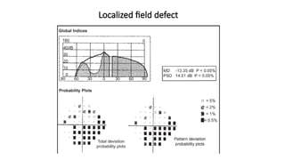 Localized Field Defect INTERPRETATION OF AUTOMATED PERIMETRY.pptx