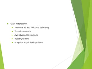  Oval macrocytes
 Vitamin B 12 and folic acid deficiency
 Pernicious anemia
 Myleodysplastic syndrome
 Hypothyroidism
 Drug that impair DNA synthesis
 