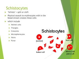 Schistocytes
 „Schisto‟ = split or cleft
 Physical assault to erythrocytes with in the
blood stream creates these cells
 which include
 Helmet cells
 Triangles
 Crescents
 Microspherocytes
 Horns
 Purse
 