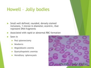 Howell – Jolly bodies
 Small well defined, rounded, densely stained
inclusions, 1 micron in diameter, ecentric, that
represent DNA fragments
 Associated with rapid or abnormal RBC formation
 Seen in
 Post spleenectomy
 Newborns
 Megaloblastic anemia
 Dyserythopoietic anemias
 Hereditary spherocyosis
 