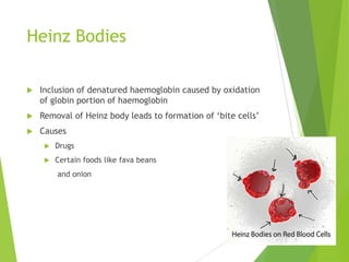 Heinz Bodies
 Inclusion of denatured haemoglobin caused by oxidation
of globin portion of haemoglobin
 Removal of Heinz body leads to formation of „bite cells‟
 Causes
 Drugs
 Certain foods like fava beans
and onion
 