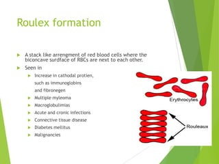 Roulex formation
 A stack like arrengment of red blood cells where the
biconcave surdface of RBCs are next to each other.
 Seen in
 Increase in cathodal protien,
such as immunoglobins
and fibronegen
 Multiple myleoma
 Macroglobulimias
 Acute and cronic infections
 Connective tissue disease
 Diabetes mellitus
 Malignancies
 