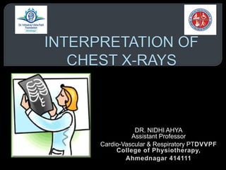 DR. NIDHI AHYA
Assistant Professor
Cardio-Vascular & Respiratory PTDVVPF
College of Physiotherapy,
Ahmednagar 414111
 