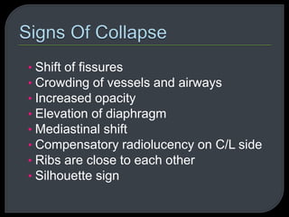 • Shift of fissures
• Crowding of vessels and airways
• Increased opacity
• Elevation of diaphragm
• Mediastinal shift
• Compensatory radiolucency on C/L side
• Ribs are close to each other
• Silhouette sign