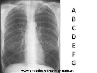 www.criticalcarepractitioner.co.uk
 