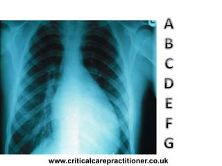 www.criticalcarepractitioner.co.uk
 