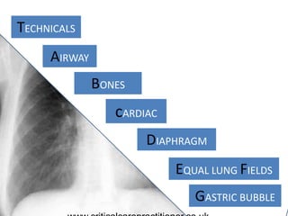 TECHNICALS
AIRWAY
BONES
cARDIAC
DIAPHRAGM
GASTRIC BUBBLE
EQUAL LUNG FIELDS
 