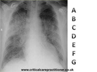 www.criticalcarepractitioner.co.uk
 