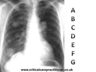 www.criticalcarepractitioner.co.uk
 