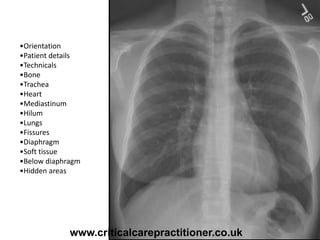 •Orientation
•Patient details
•Technicals
•Bone
•Trachea
•Heart
•Mediastinum
•Hilum
•Lungs
•Fissures
•Diaphragm
•Soft tissue
•Below diaphragm
•Hidden areas
www.criticalcarepractitioner.co.uk
 