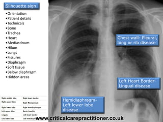Left Heart Border-
Lingual disease
Hemidiaphragm-
Left lower lobe
disease
Chest wall- Pleural,
lung or rib disease
•Orientation
•Patient details
•Technicals
•Bone
•Trachea
•Heart
•Mediastinum
•Hilum
•Lungs
•Fissures
•Diaphragm
•Soft tissue
•Below diaphragm
•Hidden areas
Silhouette sign
www.criticalcarepractitioner.co.uk
 