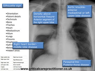 •Orientation
•Patient details
•Technicals
•Bone
•Trachea
•Heart
•Mediastinum
•Hilum
•Lungs
•Fissures
•Diaphragm
•Soft tissue
•Below diaphragm
•Hidden areas
Right heart border-
middle lobe disease
Density above
horizontal fissure-
Anterior segment of
the right upper lobe
Aortic knuckle-
anterior
mediastinal or left
upper lobe disease
Paraspinal line -
Posterior thorax disease
Silhouette sign
www.criticalcarepractitioner.co.uk
 