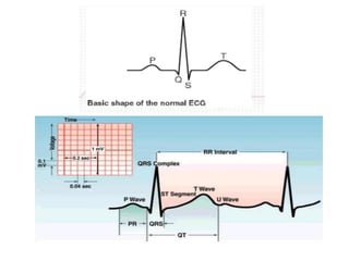 Interpretation of Clinical Lab Data [CARDIAC] for newbies.pdf