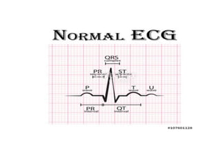 Interpretation of Clinical Lab Data [CARDIAC] for newbies.pdf