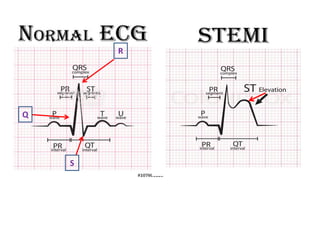 Interpretation of Clinical Lab Data [CARDIAC] for newbies.pdf