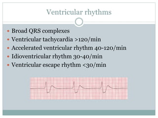 Ventricular rhythms
 Broad QRS complexes
 Ventricular tachycardia >120/min
 Accelerated ventricular rhythm 40-120/min
 Idioventricular rhythm 30-40/min
 Ventricular escape rhythm <30/min
 
