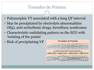 Torsades de Pointes
 Polymorphic VT associated with a long QT interval
 May be precipitated by electrolyte abnormalities
(Mg), anti-arrhythmic drugs, hereditary syndromes
 Characteristic undulating pattern on the ECG with
‘twisting of the points’
 Risk of precipitating VF
 
