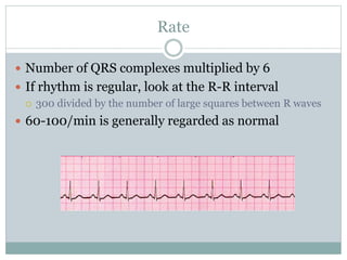 Rate
 Number of QRS complexes multiplied by 6
 If rhythm is regular, look at the R-R interval
 300 divided by the number of large squares between R waves
 60-100/min is generally regarded as normal
 