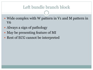 Left bundle branch block
 Wide complex with W pattern in V1 and M pattern in
V6
 Always a sign of pathology
 May be presenting feature of MI
 Rest of ECG cannot be interpreted
 