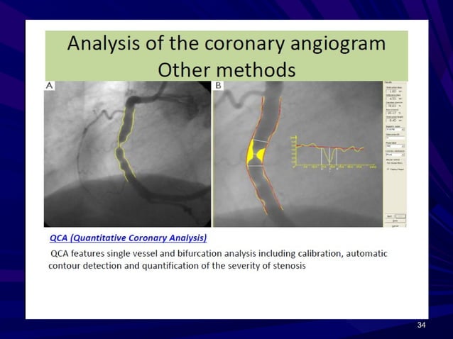 Interpretation of coronary angiogram | PPT