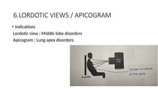 Interpretation of Chest X rays .pptx