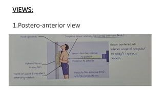 Interpretation of Chest X rays .pptx
