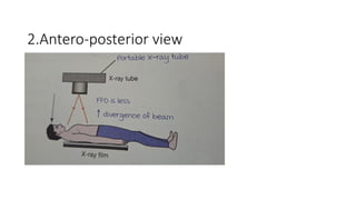 Interpretation of Chest X rays .pptx
