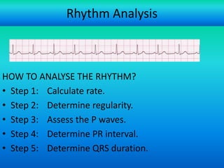 Rhythm Analysis

HOW TO ANALYSE THE RHYTHM?
• Step 1: Calculate rate.
• Step 2: Determine regularity.
• Step 3: Assess the P waves.
• Step 4: Determine PR interval.
• Step 5: Determine QRS duration.
For more presentations
www.medicalppt.blogspot.com

 