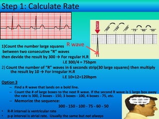 Step 1: Calculate Rate

1)Count the number large squares R wave
between two consecutive “R” waves
then devide the result by 300 → For regular H.R
i.E 300/4 = 75bpm
2) Count the number of “R” waves in 6 seconds strip(30 large squares) then multiply
the result by 10 → For irregular H.R
i.E 10×12=120bpm
Option 3
– Find a R wave that lands on a bold line.
– Count the # of large boxes to the next R wave. If the second R wave is 1 large box away
the rate is 300, 2 boxes - 150, 3 boxes - 100, 4 boxes - 75, etc.

– Memorize the sequence:
300 - 150 - 100 - 75 - 60 - 50
•
•

R-R interval is ventricular rate
For more presentations
p-p interval is atrial rate. Usually www.medicalppt.blogspot.com
the same but not always

 
