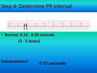 Step 4: Determine PR interval

• Normal: 0.12 - 0.20 seconds.
(3 - 5 boxes)

Interpretation?

0.12 seconds
For more presentations
www.medicalppt.blogspot.com

 