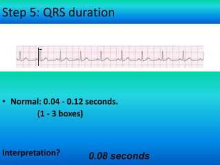 Step 5: QRS duration

• Normal: 0.04 - 0.12 seconds.
(1 - 3 boxes)

Interpretation?

0.08 seconds

 