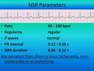 NSR Parameters

• Rate
60 - 100 bpm
• Regularity
regular
• P waves
normal
• PR interval
0.12 - 0.20 s
• QRS duration
0.04 - 0.12 s
Any deviation from above is sinus tachycardia, sinus
bradycardia or an arrhythmia
For more presentations
www.medicalppt.blogspot.com

 