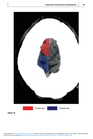 Head Ct Notes.pdf Interpretation of emergency head ct | PDF