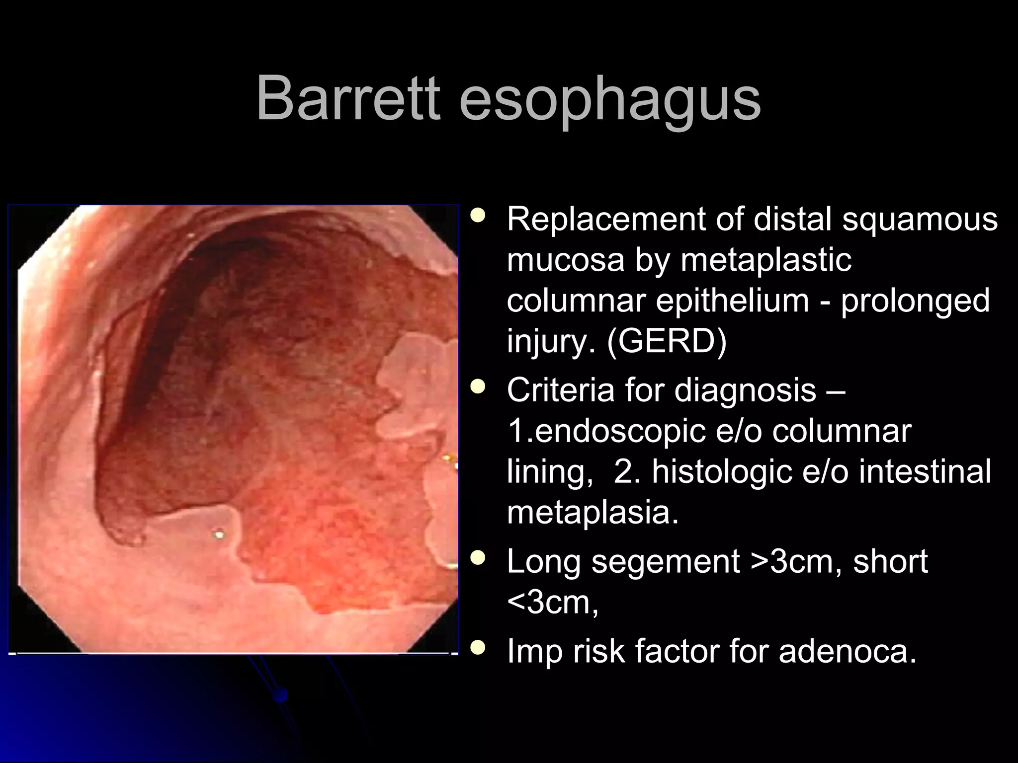 Barrett esophagusBarrett esophagus
 Replacement of distal squamousReplacement of distal squamous
mucosa by metaplasticmucosa by metaplastic
columnar epithelium - prolongedcolumnar epithelium - prolonged
injury. (GERD)injury. (GERD)
 Criteria for diagnosis –Criteria for diagnosis –
1.endoscopic e/o columnar1.endoscopic e/o columnar
lining, 2. histologic e/o intestinallining, 2. histologic e/o intestinal
metaplasia.metaplasia.
 Long segement >3cm, shortLong segement >3cm, short
<3cm,<3cm,
 Imp risk factor for adenoca.Imp risk factor for adenoca.
 