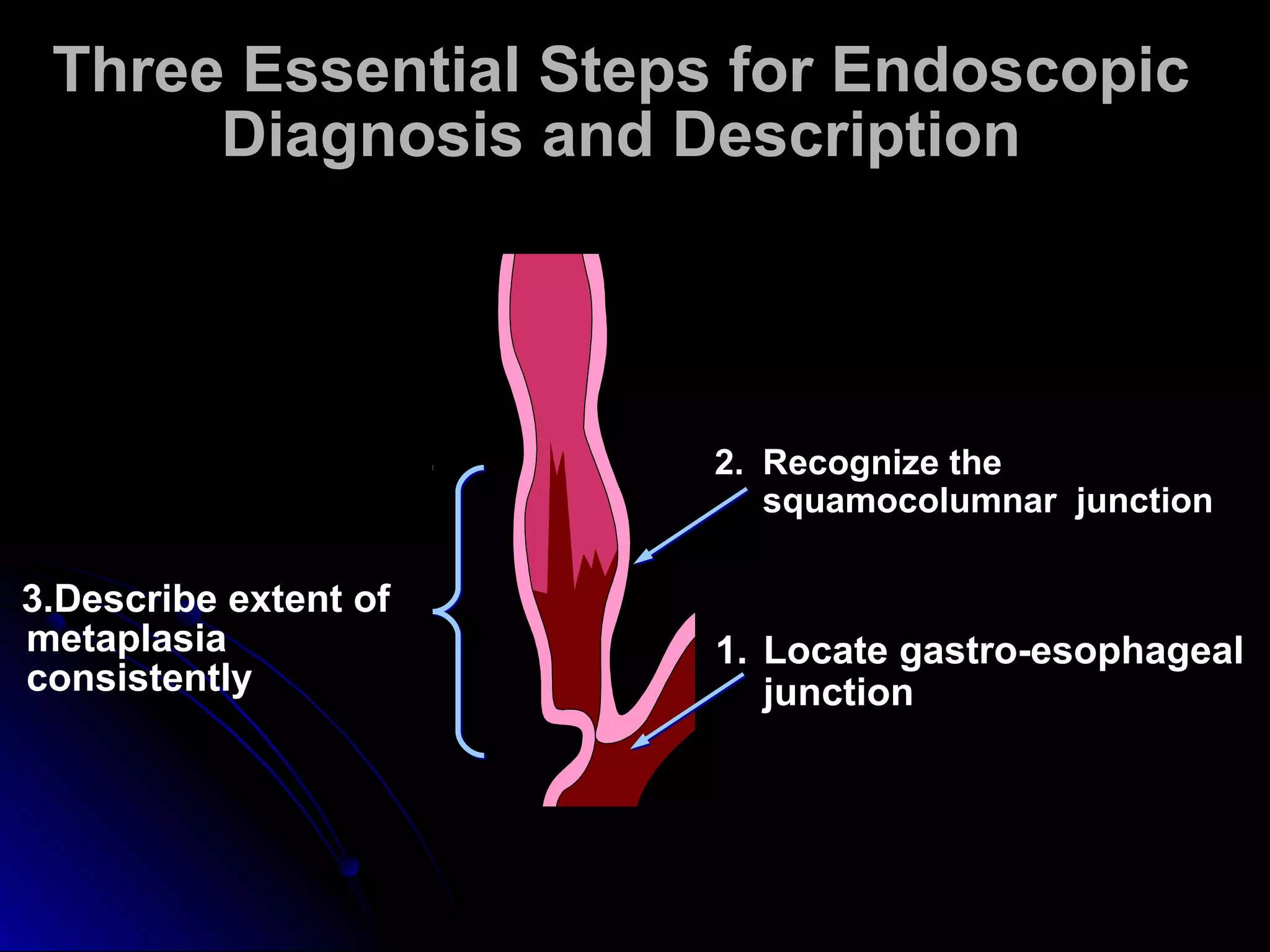 1. Locate gastro-esophageal
junction
3.Describe extent of
metaplasia
consistently
2. Recognize the
squamocolumnar junction
Three Essential Steps for Endoscopic
Diagnosis and Description
 